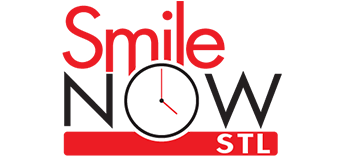 Smile Now STL